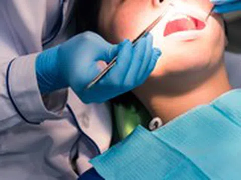 Thuốc điều trị loãng xương hoặc vệ sinh răng miệng kém có thể gây hoại tử xương hàm?