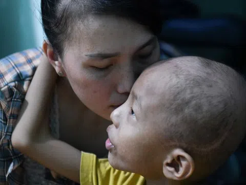 Muốn giúp trẻ bệnh nặng, hãy đến khoa ung bướu, ICU