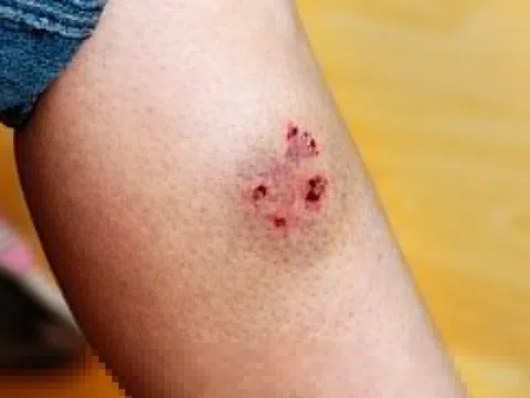 Đồng Nai đẩy mạnh tiêm vaccine dại cho đàn chó, mèo