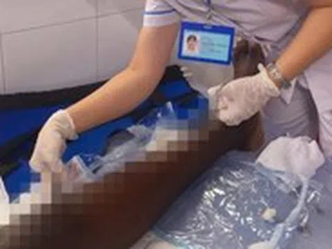 Phẫu thuật thành công cho người Nigeria bị gãy lún mâm chày nhập viện muộn 3 tuần