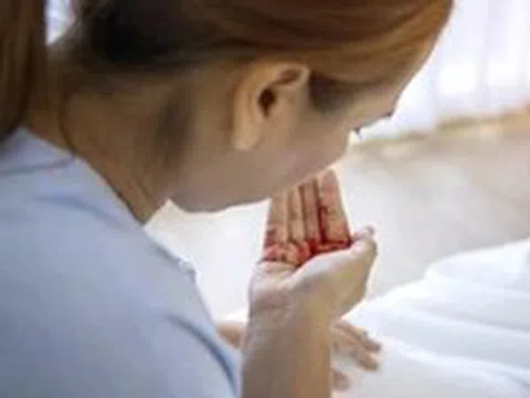 Nga tuyên bố vi rút gây ho ra máu không phải vi rút mới, không phải đột biến