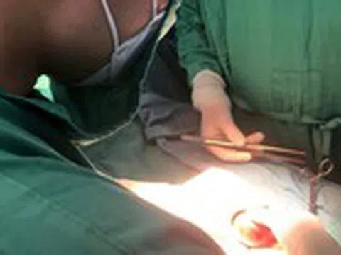 Chậm đi viện, 2 nam sinh cùng mất một bên tinh hoàn do xoắn tinh hoàn hoại tử