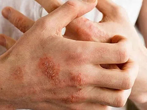 Câu hỏi thường gặp liên quan đến dị ứng thời tiết