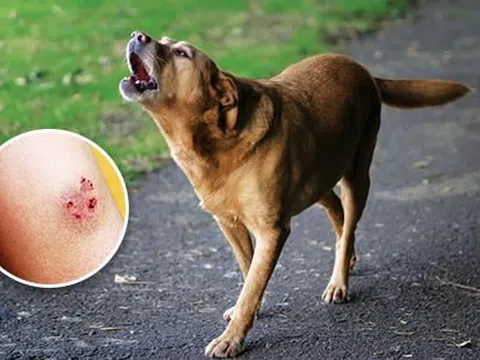Chó nghi dại cắn liên tiếp 5 người cùng xã ở Vũng Tàu