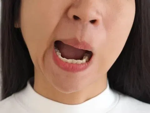 Sau cơn đau nhức trong tai, mặt người phụ nữ biến dạng