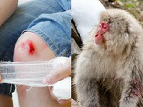 Tại sao vết thương của con người lại lâu lành hơn động vật?