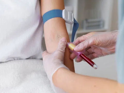 Chỉ số mỡ máu cao, điều gì đang chờ phía sau?