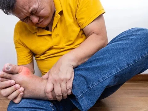 Tại sao đàn ông hay bị bệnh gout nhiều hơn?