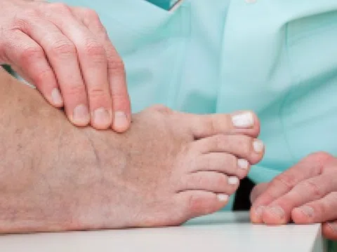 Người mắc tiểu đường, suy thận, gout nên ăn uống như thế nào?