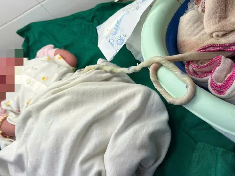 Con gặp nguy vì mẹ khăng khăng sinh con 'thuận tự nhiên' tại nhà