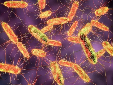 Những triệu chứng cảnh báo nhiễm khuẩn Salmonella