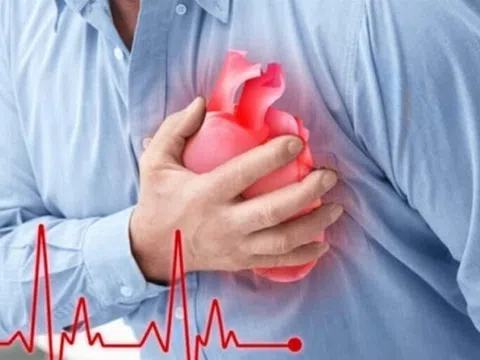 Dấu hiệu sớm cảnh báo nhồi máu cơ tim cấp