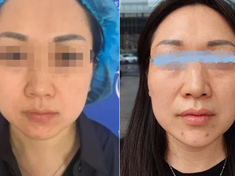 Người vợ giấu chồng vay tiền đi làm đẹp