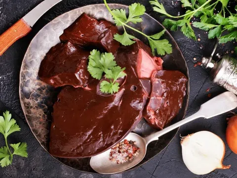 Các loại thực phẩm khiến bệnh gout tệ hơn