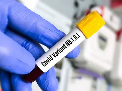 Ca mắc Covid-19 tại TP.HCM giảm 66%, ngành y tế vẫn cảnh giác