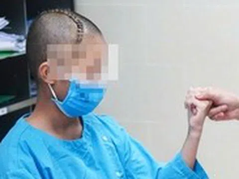 Cháu bé 13 tuổi đột quỵ khi tập văn nghệ: Cảnh giác dấu hiệu dễ bỏ qua