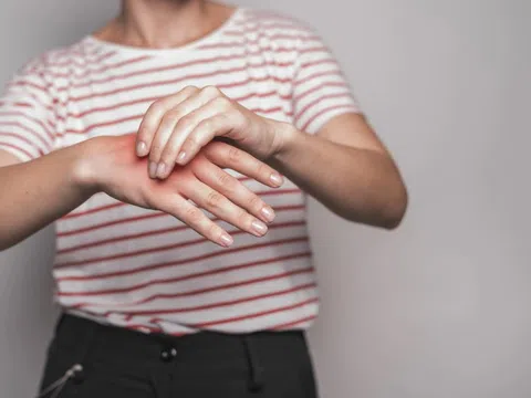Thời điểm bệnh gout dễ khởi phát