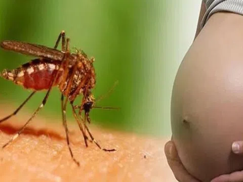 Đối tượng nào mắc sốt xuất huyết dễ bị trở nặng?