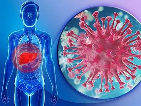 Biểu hiện của viêm gan B giai đoạn đầu
