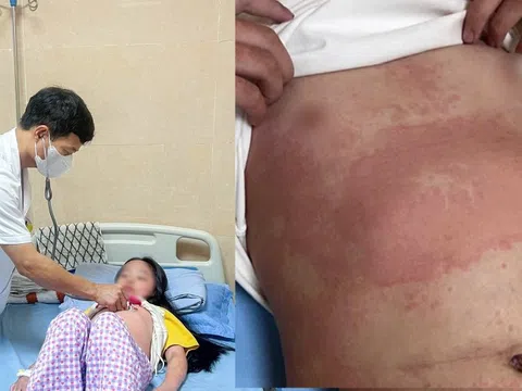 Bé gái 8 tuổi nhập viện lúc nửa đêm vì ban nhiễm khuẩn