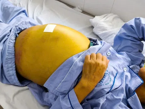 Bạn có chắc gan mình đang khỏe mạnh?