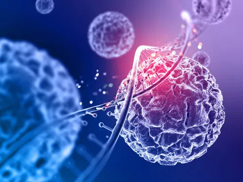 Thuốc trị ung thư do AI phát triển sắp được thử nghiệm trên người