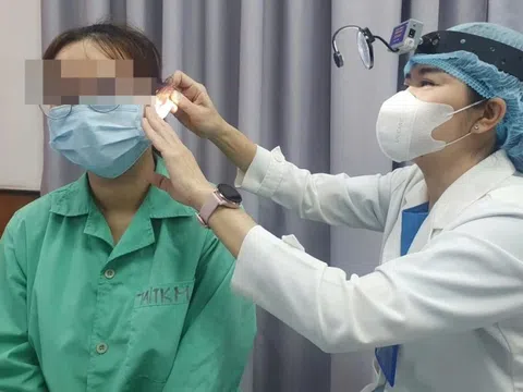 Bị vỡ xương thái dương, lệch xương bàn đạp vì ngoáy tai