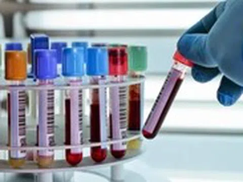 Bé trai 7 tuổi nhịn ăn gần 1 tháng vì 'viêm tụy cấp giả', bác sĩ bất ngờ tìm ra nguyên nhân