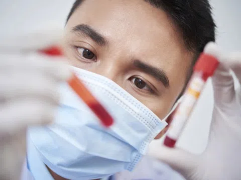Kiểu uống bia tai hại khiến thanh niên vào viện vì mỡ máu cao