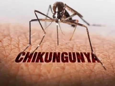 Bác sĩ Trương Hữu Khanh nói gì về bệnh Chikungunya