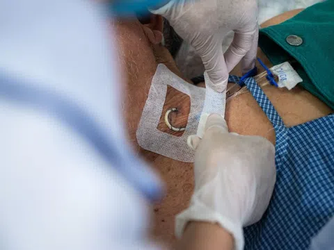 Ra đi ở tuổi 35 và căn bệnh 'quật ngã' nhiều người trẻ