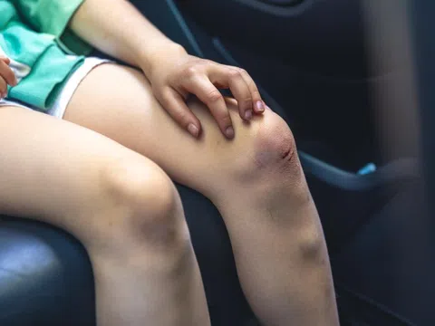 Ca mắc bệnh ung thư ở Việt Nam ngày càng tăng