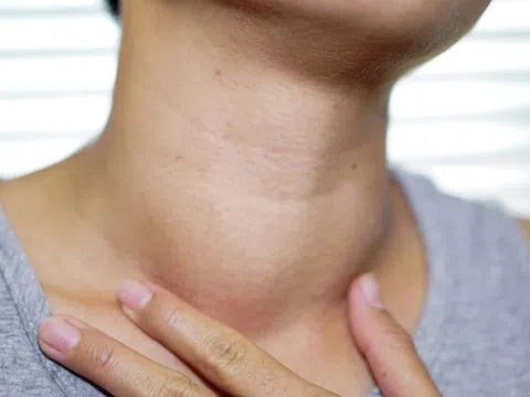 Những bộ phận cơ thể càng sưng to càng nguy hiểm