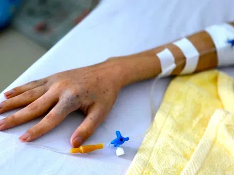 Phát hiện ung thư muộn vì chủ quan với dấu hiệu lạ khi tiểu