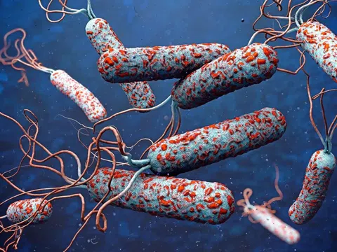 Bệnh tả bùng phát tại nhiều nước, Bộ Y tế cảnh báo nguy cơ xâm nhập