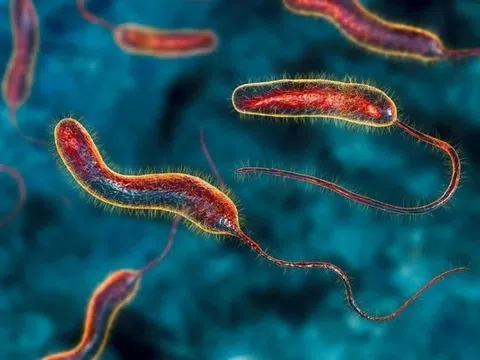 Tả là bệnh gì?