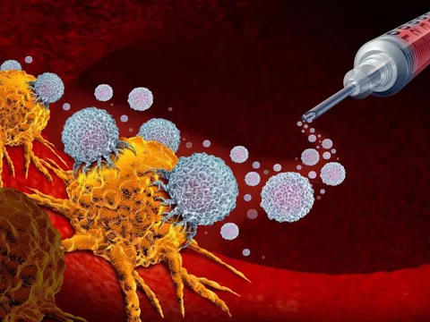 Cơ chế giúp vaccine ung thư Nga tấn công khối u