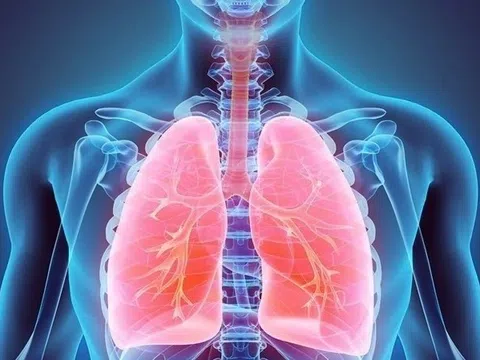 Nỗi khổ của người mắc bệnh COPD