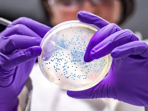Công bố 29 siêu vi khuẩn nguy hiểm nhất với con người