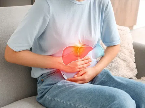 Người bệnh gan đối mặt rủi ro biến chứng khi mắc sốt xuất huyết Dengue