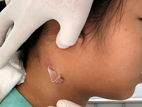 Chủ quan khi làm vườn, người đàn ông nhiễm 'khuẩn ăn thịt người'