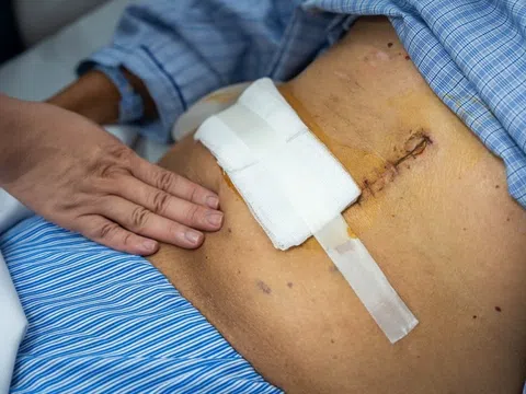 Căn bệnh gây tử vong cao nhất trong các loại ung thư