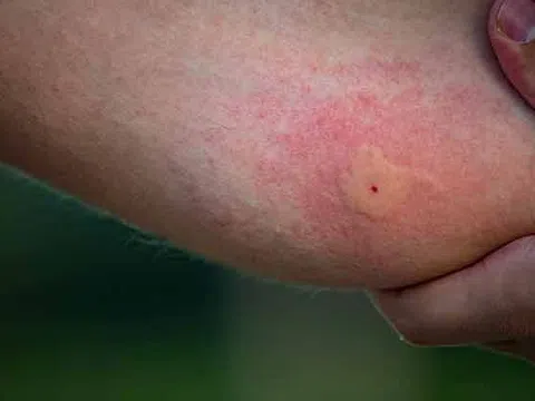 Một phường ở TP.HCM có 3 ổ dịch tại trường học chỉ trong 1 tuần