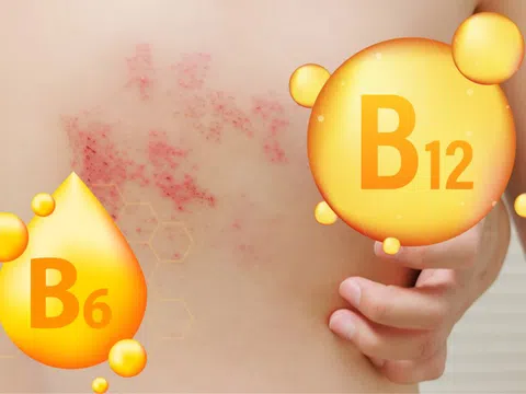 Có thể chăm sóc và hỗ trợ chữa trị người bệnh zona thần kinh bằng thực phẩm?