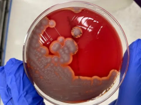 Loại vi khuẩn gây ngộ độc cấp tính, vẫn 'sống sót' dù được nấu chín