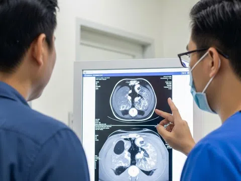 Ung thư và đột quỵ gia tăng: Có nên chụp CT để tầm soát?