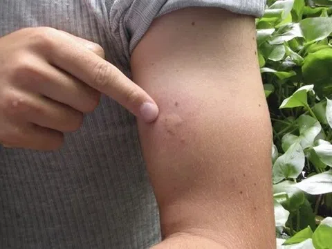 Pháp báo động vì sinh vật nhỏ lây bệnh 'nhanh như cháy rừng'