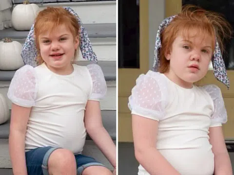 Bé gái khát nước dữ dội, sau đó phát hiện chẩn đoán đau lòng