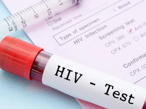 Làm thế nào để biết bạn có bị nhiễm HIV hay không?