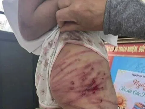 Hành vi bạo hành trẻ em sẽ bị xử lý như thế nào?